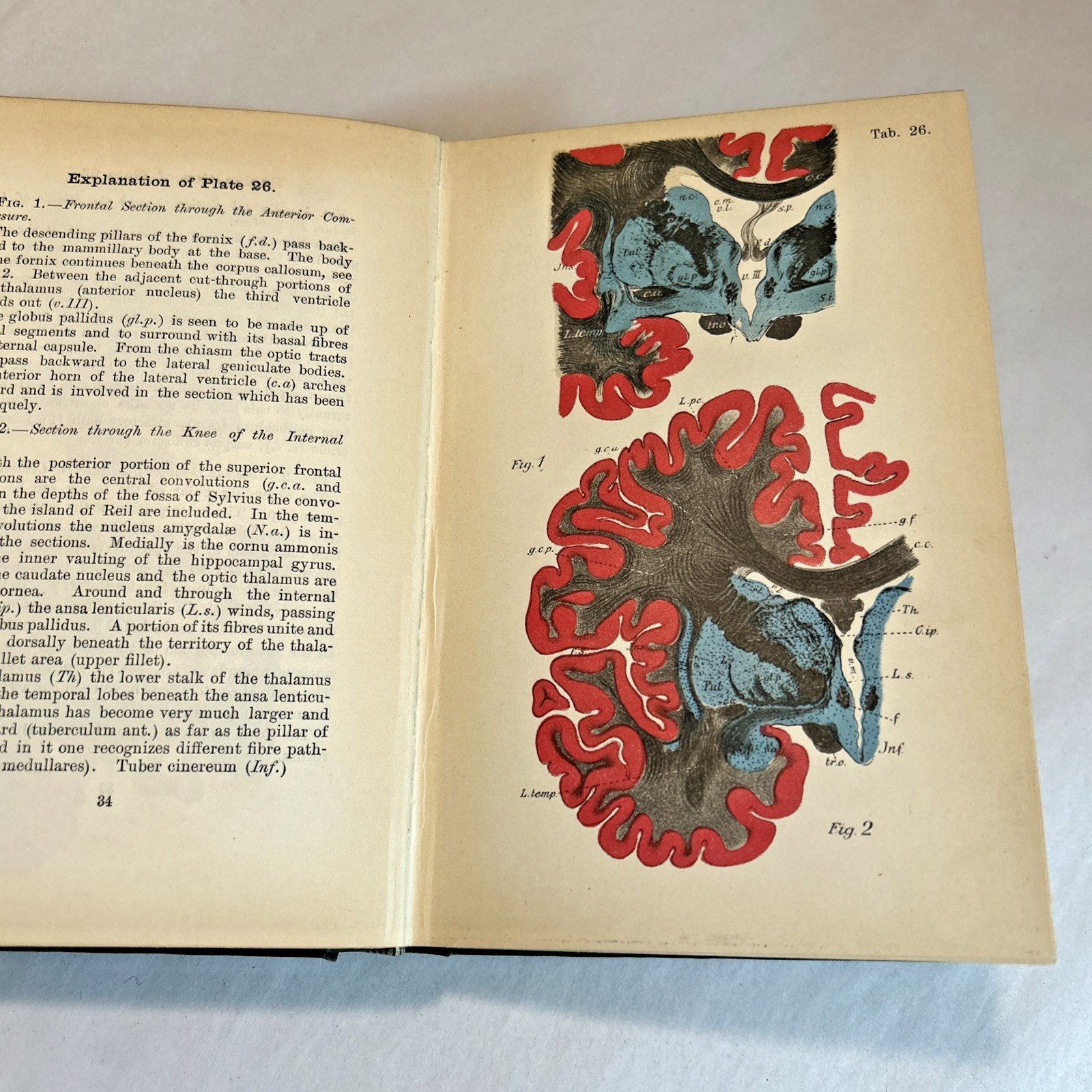 Atlas of Normal and Pathological Nervous Systems ~ 1896 ~ C. Jakob ~ Color Illus
