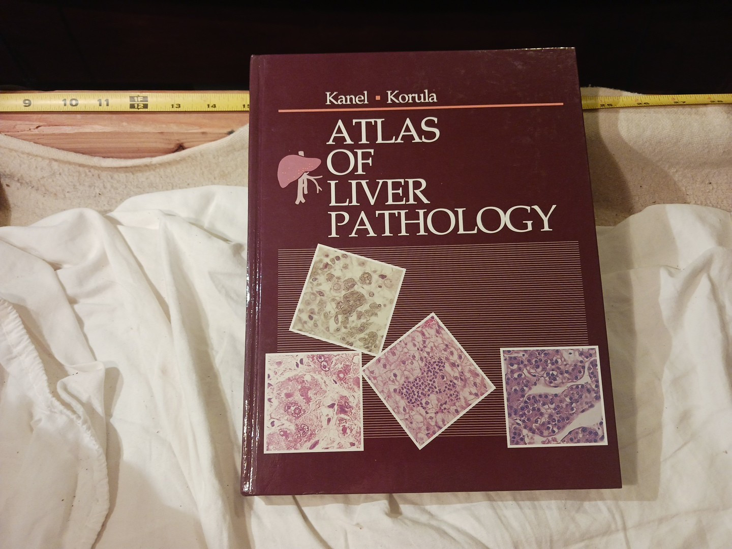 Atlas of liver pathology in hardcover Kanel – Korula copyright 1992 #S5
